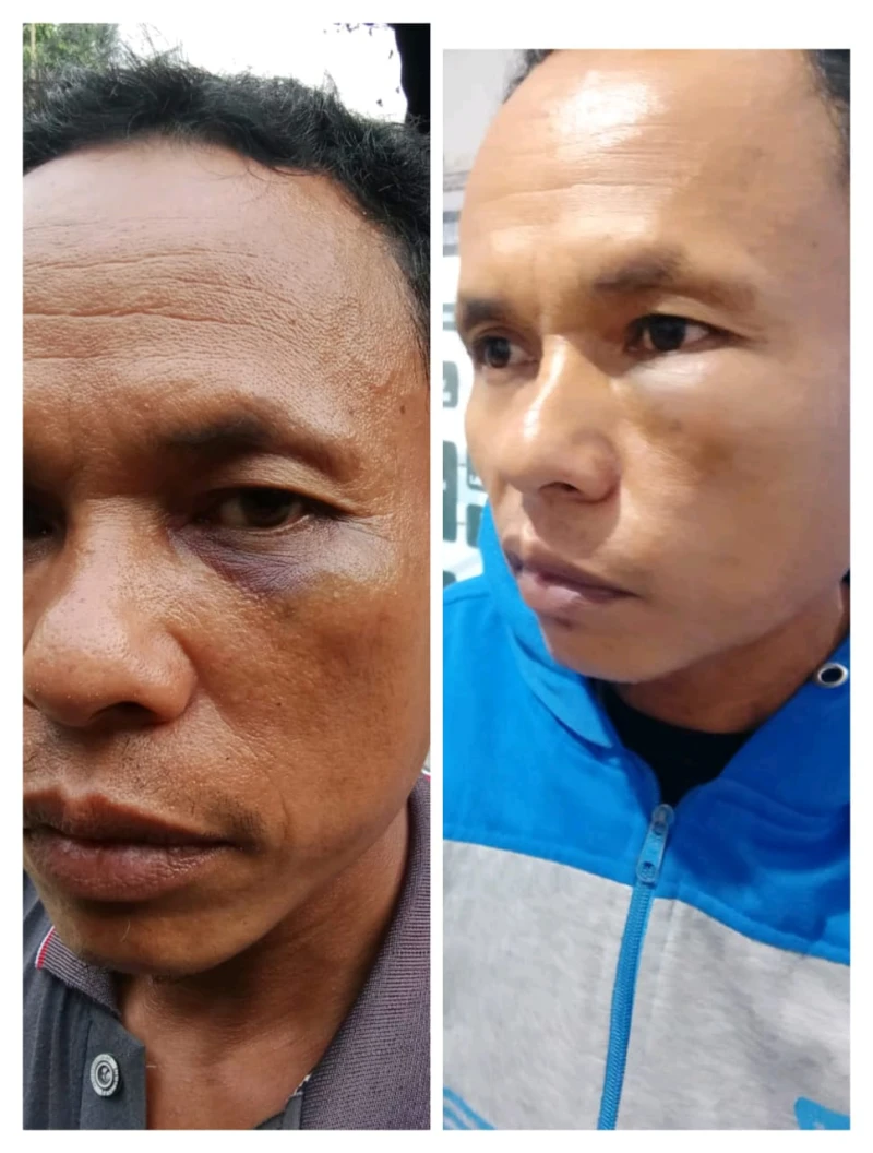 *Merasa Jadi Korban Pengeroyokan, Pria di Simalungun Justru Ditetapkan Tersangka Penganiayaan Ringan* - www.tajamnews.co.id
