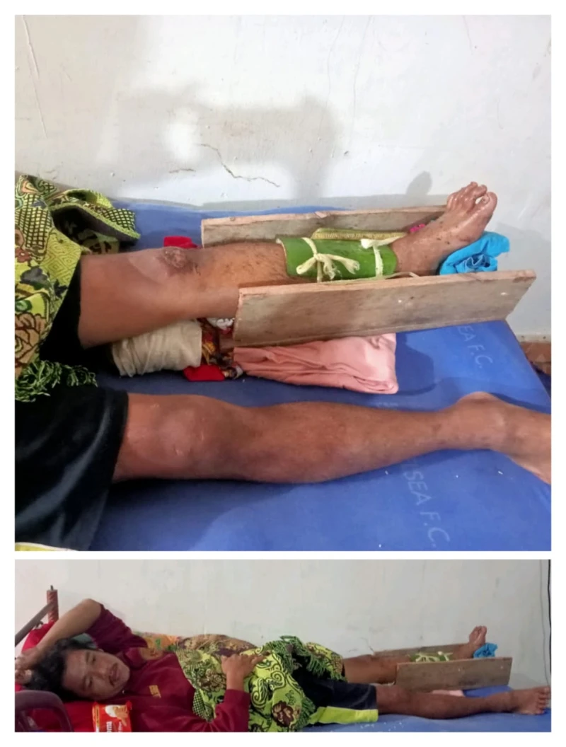 Akibat Balap Liar, Kaki Korban Alami Luka Parah di Depan Gardu Induk Pardomuan Tongah - www.tajamnews.co.id